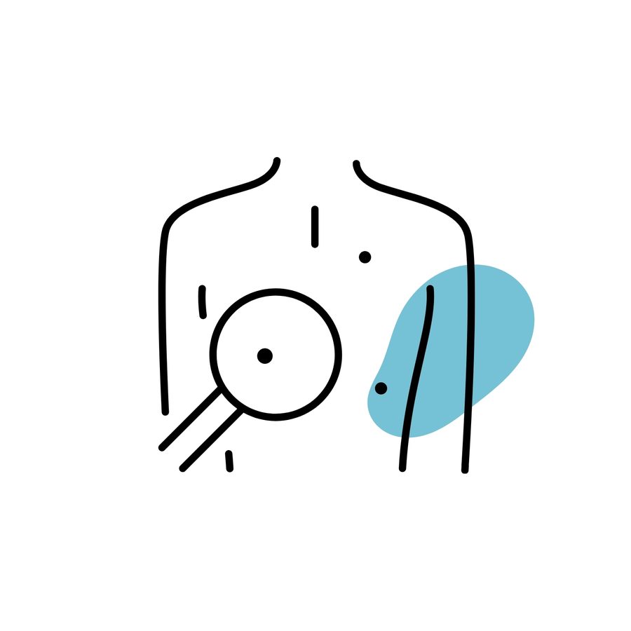 Skin Tags Removal