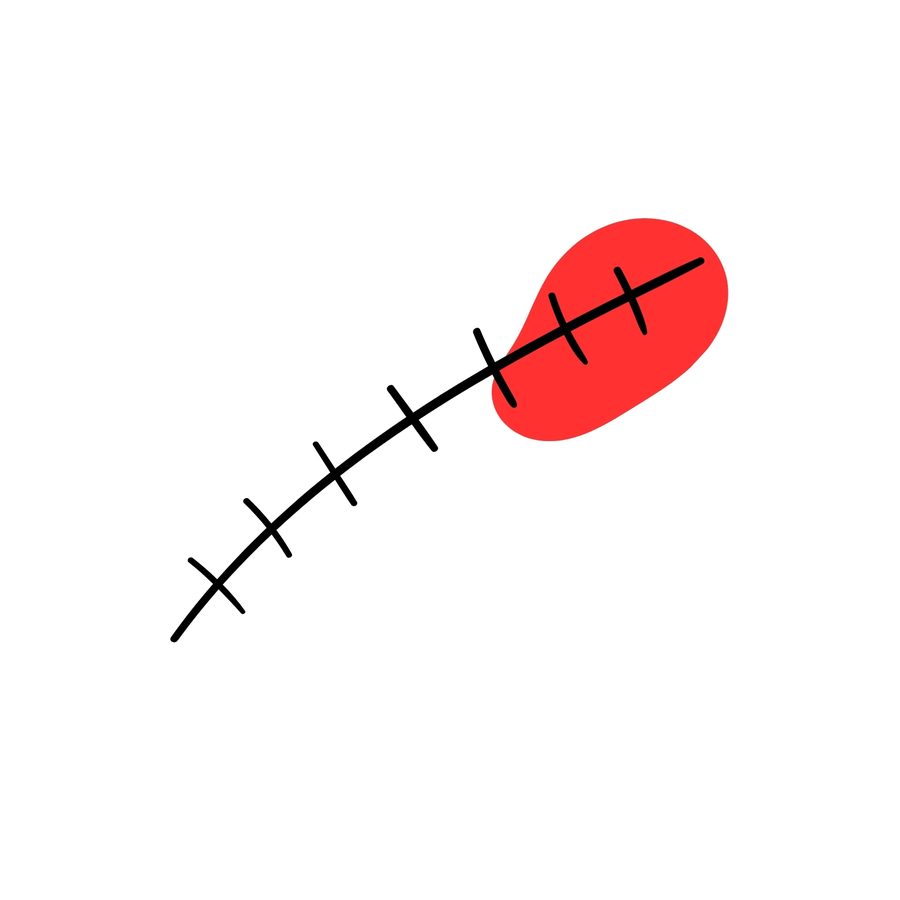 Stitches